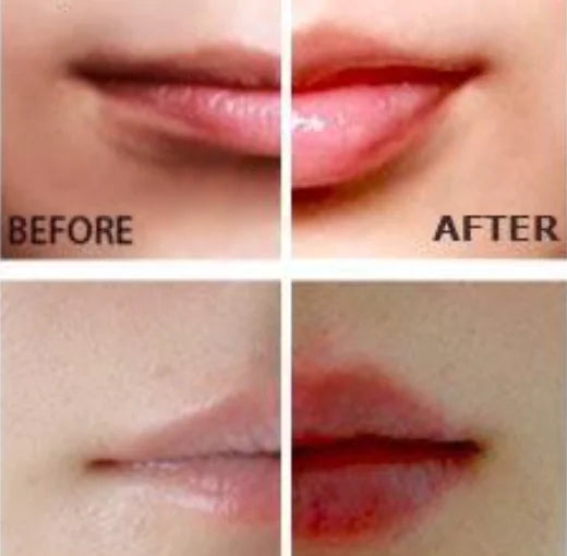 Lip Plumper