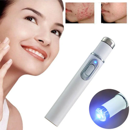 Light Therapy Acne